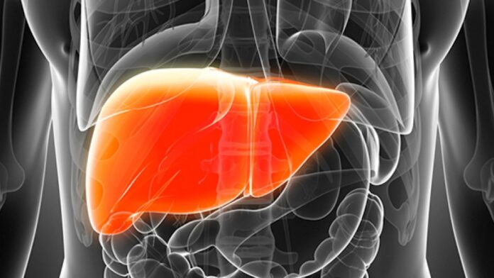 Nonalcoholic fatty liver disease (NAFLD)