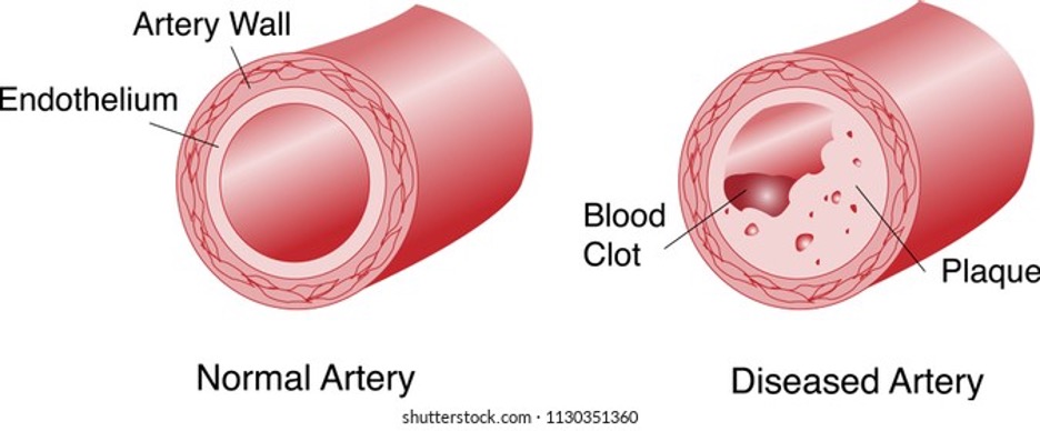 artery